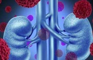 搜狗订阅:香港内部公开资料最准下载-尿毒症是什么原因导致的