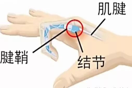 搜狐订阅：4949澳门开奖免费大全-大拇指腱鞘炎怎么治疗  第2张